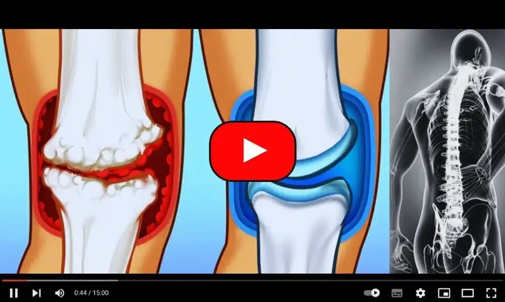 Arthritis Or Joint Pain? Do This Immediately (Try Tonight)