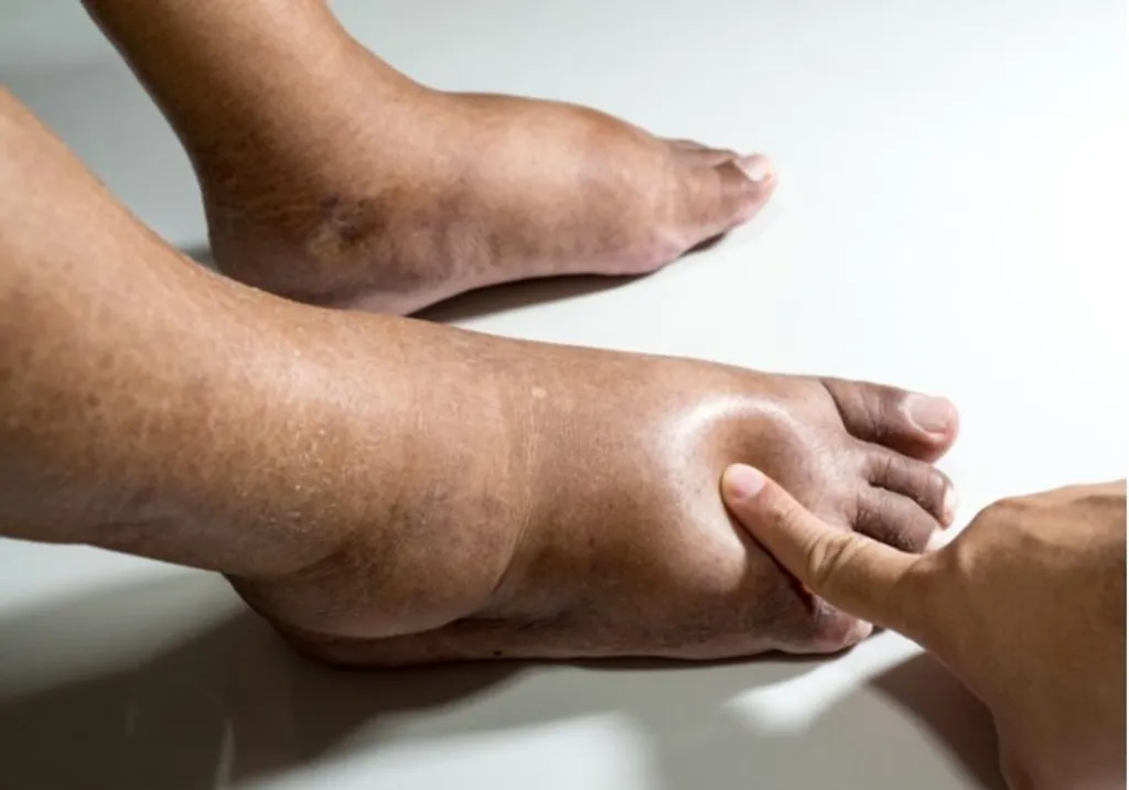 2-Minute Home Ritual Could Flush Away Stubborn Foot Swelling